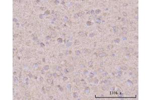 IHC analysis of PTN using anti-PTN antibody (ABIN7602164).