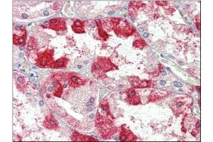 Kidney, Human: Formalin-Fixed, Paraffin-Embedded (FFPE) (Clathrin Heavy Chain (CLTC) (Heavy Chain) Antikörper)