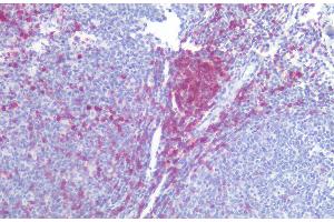 Immunohistochemistry staining of human tonsil (paraffin-embedded sections) with anti-CD5 (L17F12), 10 μg/mL. (CD5 Antikörper)