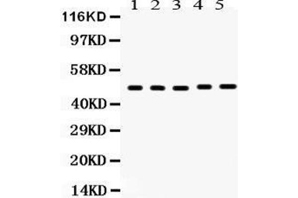 Vitamin D Receptor Antikörper  (C-Term)