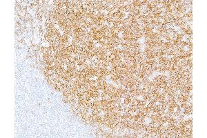 Immunohistochemistry (IHC) image for anti-CD19 Molecule (CD19) (AA 21-291) antibody (ABIN7449425)