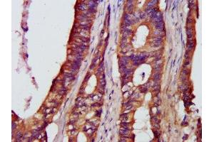 Immunohistochemistry (IHC) image for anti-Nuclear Factor of kappa Light Polypeptide Gene Enhancer in B-Cells 1 (NFKB1) (AA 1-961) antibody (ABIN7161781)