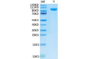 SDS-PAGE (SDS) image for CD276 (CD276) (AA 27-461) protein (Fc Tag) (ABIN7273957)