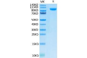 CD276 Protein (CD276) (AA 27-461) (Fc Tag)