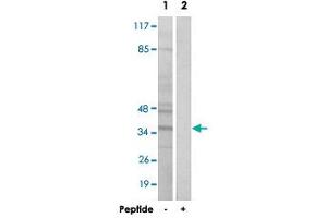Western blot analysis of extracts from Jurkat cells, using BNIP2 polyclonal antibody . (BNIP2 Antikörper  (C-Term))