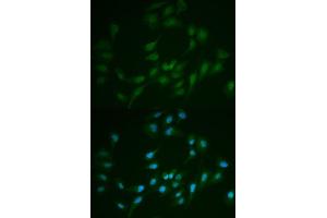Immunofluorescence analysis of MCF-7 cells using LIG1 antibody.