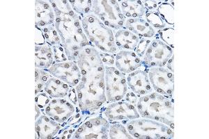 Immunohistochemistry of paraffin-embedded rat kidney using MonoMethyl-Histone H3-K27 Rabbit pAb (ABIN3023262, ABIN3023263, ABIN3023264, ABIN1513004 and ABIN6219518) at dilution of 1:100 (40x lens).