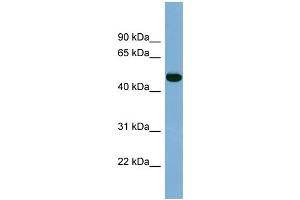 WB Suggested Anti-IRX1 Antibody Titration:  0. (IRX1 Antikörper  (Middle Region))