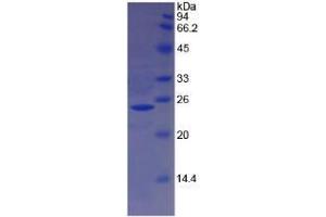 SDS-PAGE analysis of Sheep Hemoglobin beta Protein. (Hemoglobin Subunit beta Protein)