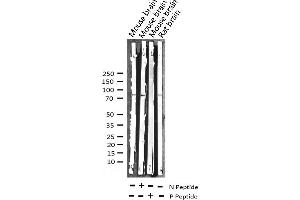 Western blot analysis of Phospho-Tau (Thr205) expression in various lysates