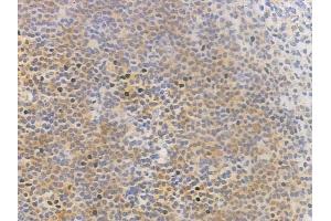 ABIN6257482 and ABIN6275890 at 1/100 staining human normal tonsil tissue by IHC-P. (RRM2B Antikörper  (N-Term))