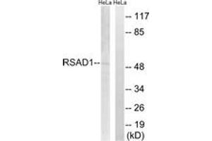 Western blot analysis of extracts from HeLa cells, using RSAD1 Antibody. (RSAD1 Antikörper  (AA 298-347))
