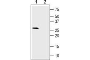 Western Blotting (WB) image for anti-Calcium Channel, Voltage-Dependent, gamma Subunit 6 (CACNG6) (AA 87-100), (Extracellular) antibody (ABIN7042994)