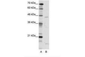Image no. 1 for anti-Thyroid Hormone Receptor Interactor 13 (TRIP13) (C-Term) antibody (ABIN202512)
