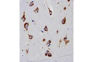 Immunohistochemical staining of paraffin-embedded human brain section reacted with RPS6 monoclonal antibody  at 1:25 dilution. (RPS6 Antikörper)