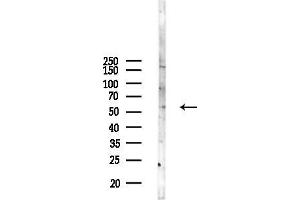 Western blot analysis of lysates from Mouse , using TSEN54 Antibody at 1/1000 dilution.