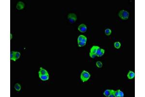 Immunofluorescent analysis of MCF-7 cells using ABIN7169819 at dilution of 1:100 and Alexa Fluor 488-congugated AffiniPure Goat Anti-Rabbit IgG(H+L) (SLIT-ROBO rho GTPase Activating Protein 2B (SRGAP2B) (AA 79-150) Antikörper)