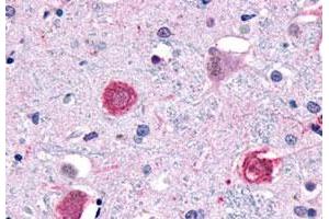 Immunohistochemistry (Formalin/PFA-fixed paraffin-embedded sections) of human brain, neurons and glia with GPR1 polyclonal antibody . (G Protein-Coupled Receptor 1 Antikörper  (C-Term))