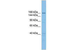 WB Suggested Anti-UBE2O Antibody Titration: 0. (UBE2O Antikörper  (Middle Region))