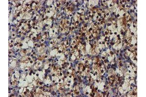 Image no. 4 for anti-NQO2 (NQO2) antibody (ABIN1499816)