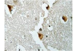 Image no. 1 for anti-Aldolase B, Fructose-Bisphosphate (ALDOB) antibody (ABIN317837) (ALDOB Antikörper)