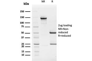 SDS-PAGE Analysis Purified Retinoblastoma (Rb1) Monoclonal Antibody (1F8).