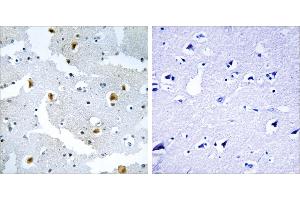 Peptide - +Immunohistochemistry analysis of paraffin-embedded human brain tissue using FMN2 antibody. (Formin 2 Antikörper  (Internal Region))