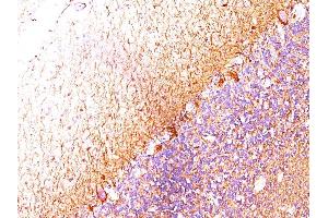 Formalin-fixed, paraffin-embedded human Cerebellum stained with Neurofilament Monoclonal Antibody (RT-97 + NR-4). (NEFH & NEFL Antikörper)