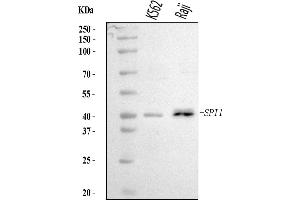 Western blot analysis of PU.