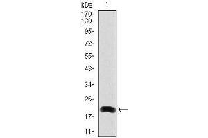 Western blot analysis using LRP5 mAb against human LRP5 (AA: 1422-1615) recombinant protein. (LRP5 Antikörper)