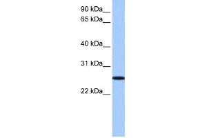WB Suggested Anti-FBXO36 Antibody Titration: 0.