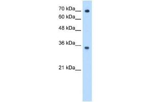 FCGRT antibody used at 0. (FcRn Antikörper  (N-Term))