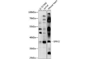 Western blot analysis of extracts of various cell lines, using SPRY2 antibody  at 1:1000 dilution. (SPRY2 Antikörper  (AA 1-100))