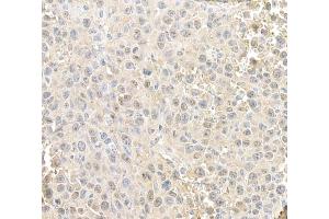 Immunohistochemistry (IHC) image for anti-RAN, Member RAS Oncogene Family (RAN) (AA 166-216) antibody (ABIN7455018)