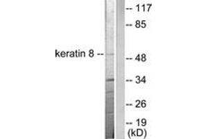 Western blot analysis of extracts from SKOV3 cells, using Keratin 8 Antibody. (KRT8 Antikörper  (AA 434-483))