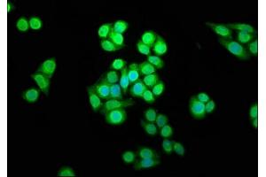 Immunofluorescence staining of PC-3 cells with ABIN7169503 at 1:166, counter-stained with DAPI. (SHARPIN Antikörper  (AA 82-171))