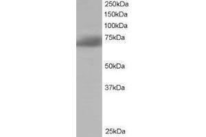 Western Blotting (WB) image for SH3-Domain Binding Protein 1 (SH3BP1) peptide (ABIN369576) (SH3-Domain Binding Protein 1 (SH3BP1) Peptid)