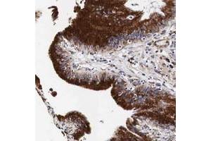 Immunohistochemical staining of human gallbladder with CKAP4 polyclonal antibody  shows distinct cytoplasmic positivity in glandular cells. (CKAP4 Antikörper  (AA 411-520))