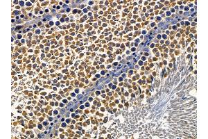 ABIN6257500 and ABIN6274303 at 1/100 staining rat testis tissue by IHC-P. (ST5 Antikörper  (Internal Region))
