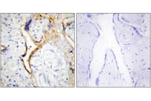 Immunohistochemistry analysis of paraffin-embedded human placenta tissue, using CKI-epsilon Antibody. (CK1 epsilon Antikörper  (AA 276-325))