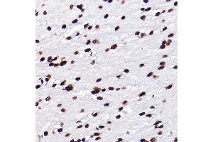 Immunohistochemistry of paraffin-embedded rat brain using MonoMethyl-Histone H3-K18 Rabbit mAb (ABIN7267683) at dilution of 1:100 (40x lens).