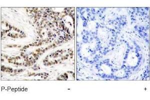 Image no. 1 for anti-cAMP Responsive Element Binding Protein 1 (CREB1) (pSer129) antibody (ABIN197038) (CREB1 Antikörper  (pSer129))