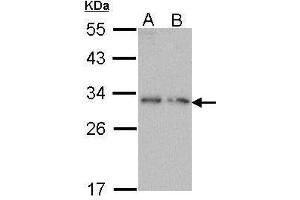WB Image Sample (30 ug of whole cell lysate) A: Molt-4 , B: Raji 12% SDS PAGE antibody diluted at 1:1000 (PDYN Antikörper)