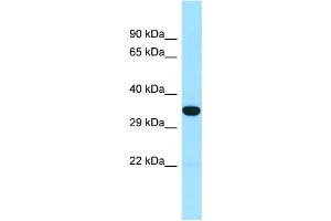WB Suggested Anti-SNX15 Antibody Titration: 1. (SNX15 Antikörper  (N-Term))