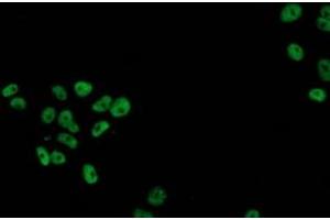 Anti-TP53 mouse monoclonal antibody (ABIN2454590) immunofluorescent staining of COS7 cells transiently transfected by pCMV6-ENTRY TP53 (RC200003). (p53 Antikörper)