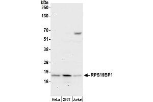 anti-Ribosomal Protein S19 Binding Protein 1 (RPS19BP1) (AA 86-136) antibody