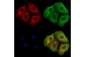 ABIN7094472 and ABIN7098520 staining Hela cells by IF/ICC.