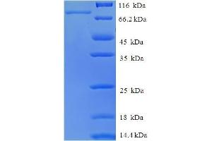 SDS-PAGE (SDS) image for RAR-Related Orphan Receptor C (RORC) (AA 1-518), (full length) protein (His-SUMO Tag) (ABIN5710270) (RORC Protein (AA 1-518, full length) (His-SUMO Tag))