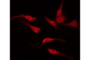 ABIN6276010 staining NIH-3T3 by IF/ICC. (GPR135 Antikörper  (Internal Region))