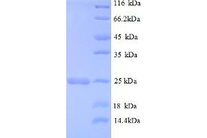 SDS-PAGE (SDS) image for HRas proto-oncogene, GTPase (HRAS) (AA 2-186) protein (His tag) (ABIN5712980) (HRAS Protein (AA 2-186) (His tag))